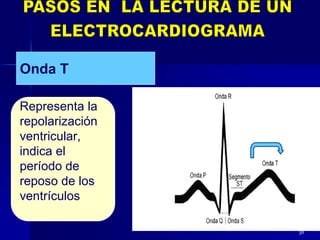 38
Representa la
repolarización
ventricular,
indica el
período de
reposo de los
ventrículos
Onda T
 