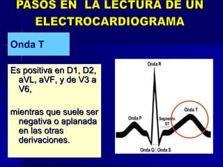 Es positiva en D1, D2,Es positiva en D1, D2,
aVLaVL,, aVFaVF, y de V3 a, y de V3 a
V6,V6,
mientras que suele sermientras que suele ser
negativa o aplanadanegativa o aplanada
en las otrasen las otras
derivaciones.derivaciones.
Onda T
 