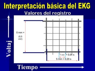 Tiempo
Voltaj
e
5 mm =
(0,5
mV)
5 mm = 0,20 s
1 mm = 0,04 s
Valores del registroValores del registro
 