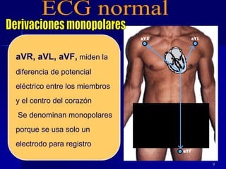 9
aVR, aVL, aVF, miden la
diferencia de potencial
eléctrico entre los miembros
y el centro del corazón
Se denominan monopolares
porque se usa solo un
electrodo para registro
 