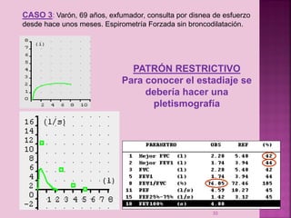 CASO 3: Varón, 69 años, exfumador, consulta por disnea de esfuerzo
desde hace unos meses. Espirometría Forzada sin broncodilatación.

PATRÓN RESTRICTIVO
Para conocer el estadiaje se
debería hacer una
pletismografía

33

 
