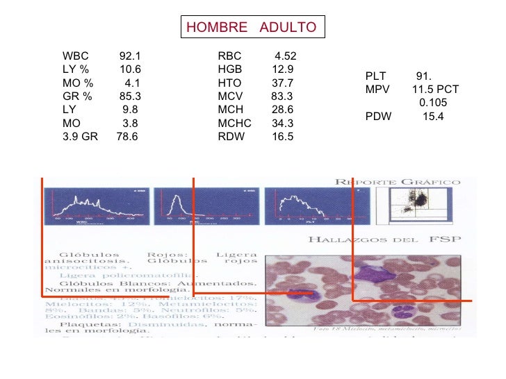 Hemograma Rdw