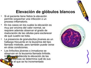 Elevación de glóbulos blancos
• Si el paciente tiene fiebre la elevación
permite sospechar una infección o un
proceso inflamatorio.
• En los casos en los cuales la elevación es
muy por encima del valor normal, se
requiere además observar el grado de
maduración de las células para esclarecer
de qué cuadro se trata.
• La presencia de granulocitos jóvenes es un
hallazgo frecuente en la leucemia del tipo
llamado mieloide, pero también puede verse
en otras condiciones.
• Los linfocitos jóvenes o inmaduros se
observan en la leucemia llamada linfoide.
Una vez establecida la elevación de las
células blancas se determina cuál de sus
tipos es el que se ha incrementado
 