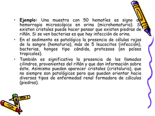 • Ejemplo: Una muestra con 50 hematíes es signo de
hemorragia microscópica en orina (microhematuria). Si
existen cristales puede hacer pensar que existen piedras de
riñón. Si se ven bacterias es que hay infección de orina.
• En el sedimento es patológica la presencia de células rojas
de la sangre (hematuria), más de 5 leucocitos (infección),
bacterias, hongos tipo cándida, protozoos (en países
tropicales).
• También es significativa la presencia de los llamados
cilindros, provenientes del riñón y que dan información sobre
éste. Asimismo pueden aparecer cristales (cristaluria), que
no siempre son patológicos pero que pueden orientar hacia
diversos tipos de enfermedad renal formadora de cálculos
(piedras).
 