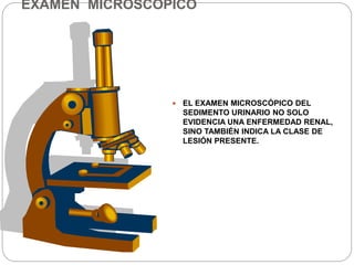 EXAMEN MICROSCOPICO
 EL EXAMEN MICROSCÓPICO DEL
SEDIMENTO URINARIO NO SOLO
EVIDENCIA UNA ENFERMEDAD RENAL,
SINO TAMBIÉN INDICA LA CLASE DE
LESIÓN PRESENTE.
 