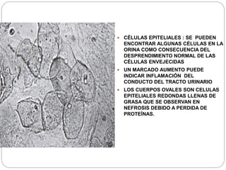  CÉLULAS EPITELIALES : SE PUEDEN
ENCONTRAR ALGUNAS CÉLULAS EN LA
ORINA COMO CONSECUENCIA DEL
DESPRENDIMIENTO NORMAL DE LAS
CÉLULAS ENVEJECIDAS
 UN MARCADO AUMENTO PUEDE
INDICAR INFLAMACIÓN DEL
CONDUCTO DEL TRACTO URINARIO
 LOS CUERPOS OVALES SON CELULAS
EPITELIALES REDONDAS LLENAS DE
GRASA QUE SE OBSERVAN EN
NEFROSIS DEBIDO A PERDIDA DE
PROTEÍNAS.
 