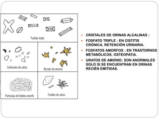  CRISTALES DE ORINAS ALCALINAS :
 FOSFATO TRIPLE : EN CISTITIS
CRÓNICA, RETENCIÓN URINARIA.
 FOSFATOS AMORFOS : EN TRASTORNOS
METABÓLICOS, OSTEOPATIA.
 URATOS DE AMONIO: SON ANORMALES
SOLO SI SE ENCUENTRAN EN ORINAS
RECIÉN EMITIDAS.
 