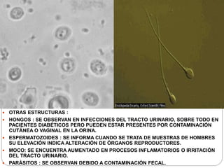  OTRAS ESTRUCTURAS :
 HONGOS : SE OBSERVAN EN INFECCIONES DEL TRACTO URINARIO, SOBRE TODO EN
PACIENTES DIABÉTICOS PERO PUEDEN ESTAR PRESENTES POR CONTAMINACIÓN
CUTÁNEA O VAGINAL EN LA ORINA.
 ESPERMATOZOIDES : SE INFORMA CUANDO SE TRATA DE MUESTRAS DE HOMBRES
SU ELEVACIÓN INDICA ALTERACIÓN DE ÓRGANOS REPRODUCTORES.
 MOCO: SE ENCUENTRA AUMENTADO EN PROCESOS INFLAMATORIOS O IRRITACIÓN
DEL TRACTO URINARIO.
 PARÁSITOS : SE OBSERVAN DEBIDO A CONTAMINACIÓN FECAL.
 