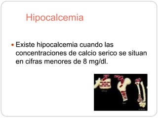 Hipocalcemia
 Existe hipocalcemia cuando las
concentraciones de calcio serico se situan
en cifras menores de 8 mg/dl.
 