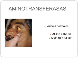 AMINOTRANSFERASAS
 Valores normales
 ALT: 8 a 37UI/L
 AST: 10 a 34 UI/L
 