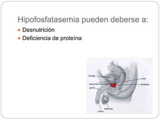 Hipofosfatasemia pueden deberse a:
 Desnutrición
 Deficiencia de proteína
 