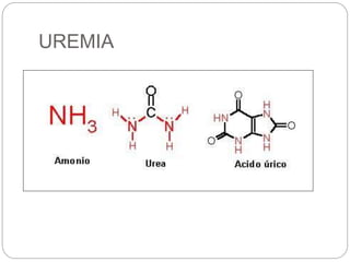 UREMIA
 