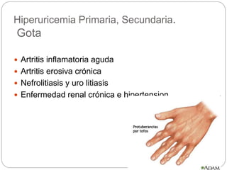 Hiperuricemia Primaria, Secundaria.
Gota
 Artritis inflamatoria aguda
 Artritis erosiva crónica
 Nefrolitiasis y uro litiasis
 Enfermedad renal crónica e hipertension
 