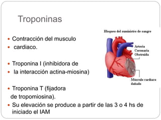 Troponinas
 Contracción del musculo
 cardiaco.
 Troponina I (inhibidora de
 la interacción actina-miosina)
 Troponina T (fijadora
de tropomiosina).
 Su elevación se produce a partir de las 3 o 4 hs de
iniciado el IAM
 