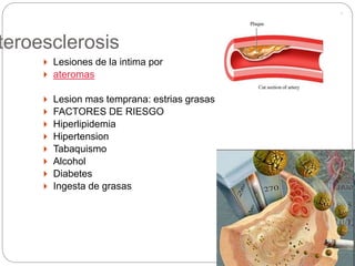 teroesclerosis
 Lesiones de la intima por
 ateromas
 Lesion mas temprana: estrias grasas
 FACTORES DE RIESGO
 Hiperlipidemia
 Hipertension
 Tabaquismo
 Alcohol
 Diabetes
 Ingesta de grasas
 