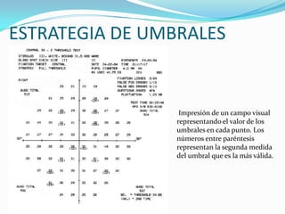 ESTRATEGIA DE UMBRALES

Impresión de un campo visual
representando el valor de los
umbrales en cada punto. Los
números entre paréntesis
representan la segunda medida
del umbral que es la más válida.

 