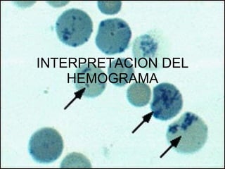 INTERPRETACION DEL HEMOGRAMA 