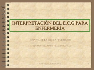INTERPRETACIÓN DEL E.C.G PARA ENFERMERÍA HOSPITAL DE LA RIBERA / ENERO 2000 MATILDE MONTOYA MARTÍ  ( D.U.E 5 ª PLANTA ). 