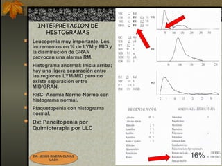 INTERPRETACION HISTOGRAMAS EJEMPLO CASOS CD 1700.ppt