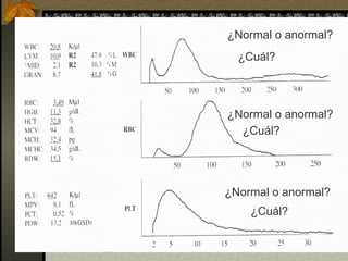INTERPRETACION HISTOGRAMAS EJEMPLO CASOS CD 1700.ppt