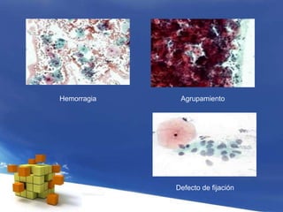 Hemorragia Agrupamiento
Defecto de fijación
 
