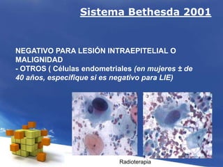 Sistema Bethesda 2001
NEGATIVO PARA LESIÓN INTRAEPITELIAL O
MALIGNIDAD
- OTROS ( Células endometriales (en mujeres ± de
40 años, especifique si es negativo para LIE)
Radioterapia
 