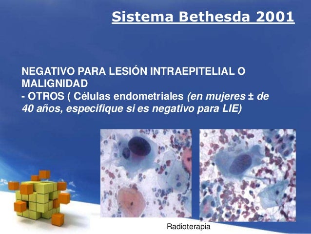 Interpretacion pap