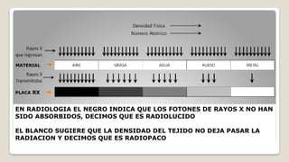 INTERPRETACION RADIOGRAFIA PARA LA CARRERA DE ODONTOLOGÍA | PPTX