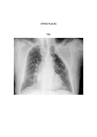 OTRAS PLACAS



    TBC
 