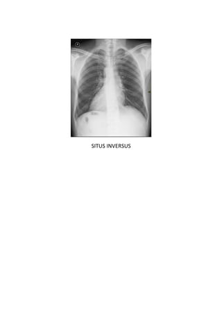 SITUS INVERSUS
 