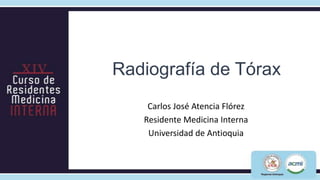 Radiografía de Tórax
    Carlos José Atencia Flórez
   Residente Medicina Interna
    Universidad de Antioquia
 