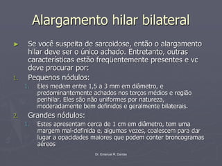 Dr. Emanuel R. Dantas
Alargamento hilar bilateral
► Se você suspeita de sarcoidose, então o alargamento
hilar deve ser o único achado. Entretanto, outras
características estão freqüentemente presentes e vc
deve procurar por:
1. Pequenos nódulos:
1. Eles medem entre 1,5 a 3 mm em diâmetro, e
predominantemente achados nos terços médios e região
perihilar. Eles são não uniformes por natureza,
moderadamente bem definidos e geralmente bilaterais.
2. Grandes nódulos:
1. Estes apresentam cerca de 1 cm em diâmetro, tem uma
margem mal-definida e, algumas vezes, coalescem para dar
lugar a opacidades maiores que podem conter broncogramas
aéreos
 