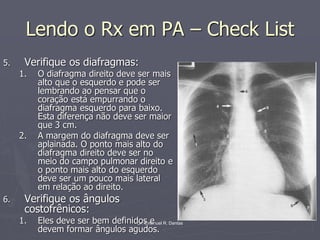 Dr. Emanuel R. Dantas
Lendo o Rx em PA – Check List
5. Verifique os diafragmas:
1. O diafragma direito deve ser mais
alto que o esquerdo e pode ser
lembrando ao pensar que o
coração está empurrando o
diafragma esquerdo para baixo.
Esta diferença não deve ser maior
que 3 cm.
2. A margem do diafragma deve ser
aplainada. O ponto mais alto do
diafragma direito deve ser no
meio do campo pulmonar direito e
o ponto mais alto do esquerdo
deve ser um pouco mais lateral
em relação ao direito.
6. Verifique os ângulos
costofrênicos:
1. Eles deve ser bem definidos e
devem formar ângulos agudos.
 
