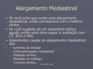Dr. Emanuel R. Dantas
Alargamento Mediastinal
► Se você acha que existe uma alargamento
mediastinal, então correlacione com a história
clínica.
► Se você suspeita de um aneurisma aórtico
agudo, então você deve seguir a avaliação com
CT, ECO e MRI.
► Importantes causas de alargamento mediastinal
são:
▪ Aumento da tireóide
▪ Linfonodomegalia mediastinal
▪ Dilatação aórtica
▪ Dilatação do esôfago
▪ Tumores tímicos.
 