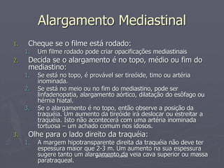 Dr. Emanuel R. Dantas
Alargamento Mediastinal
1. Cheque se o filme está rodado:
1. Um filme rodado pode criar opacificações mediastinais
2. Decida se o alargamento é no topo, médio ou fim do
mediastino:
1. Se está no topo, é provável ser tireóide, timo ou artéria
inominada.
2. Se está no meio ou no fim do mediastino, pode ser
linfadenopatia, alargamento aórtico, dilatação do esôfago ou
hérnia hiatal.
3. Se o alargamento é no topo, então observe a posição da
traquéia. Um aumento da tireóide irá deslocar ou estreitar a
traquéia. Isto não acontecerá com uma artéria inominada
tortuosa – um achado comum nos idosos.
3. Olhe para o lado direito da traquéia:
1. A margem hipotransparente direita da traquéia não deve ter
espessura maior que 2-3 m. Um aumento na sua espessura
sugere tanto um alargamento da veia cava superior ou massa
paratraqueal.
 