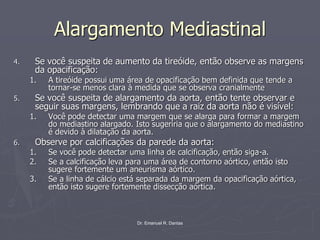 Dr. Emanuel R. Dantas
Alargamento Mediastinal
4. Se você suspeita de aumento da tireóide, então observe as margens
da opacificação:
1. A tireóide possui uma área de opacificação bem definida que tende a
tornar-se menos clara à medida que se observa cranialmente
5. Se você suspeita de alargamento da aorta, então tente observar e
seguir suas margens, lembrando que a raiz da aorta não é visível:
1. Você pode detectar uma margem que se alarga para formar a margem
do mediastino alargado. Isto sugeriria que o alargamento do mediastino
é devido à dilatação da aorta.
6. Observe por calcificações da parede da aorta:
1. Se você pode detectar uma linha de calcificação, então siga-a.
2. Se a calcificação leva para uma área de contorno aórtico, então isto
sugere fortemente um aneurisma aórtico.
3. Se a linha de cálcio está separada da margem da opacificação aórtica,
então isto sugere fortemente dissecção aórtica.
 