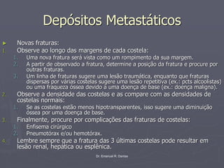 Dr. Emanuel R. Dantas
Depósitos Metastáticos
► Novas fraturas:
1. Observe ao longo das margens de cada costela:
1. Uma nova fratura será vista como um rompimento da sua margem.
2. A partir de observado a fratura, determine a posição da fratura e procure por
outras fraturas.
3. Um linha de fraturas sugere uma lesão traumática, enquanto que fraturas
dispersas por várias costelas sugere uma lesão repetitiva (ex.: pcts alcoolistas)
ou uma fraqueza óssea devido a uma doença de base (ex.: doença maligna).
2. Observe a densidade das costelas e as compare com as densidades de
costelas normais:
1. Se as costelas estão menos hipotransparentes, isso sugere uma diminuição
óssea por uma doença de base.
3. Finalmente, procure por complicações das fraturas de costelas:
1. Enfisema cirúrgico
2. Pneumotórax e/ou hemotórax.
4. Lembre sempre que a fratura das 3 últimas costelas pode resultar em
lesão renal, hepática ou esplênica.
 