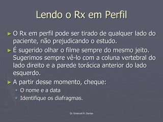 Dr. Emanuel R. Dantas
Lendo o Rx em Perfil
► O Rx em perfil pode ser tirado de qualquer lado do
paciente, não prejudicando o estudo.
► É sugerido olhar o filme sempre do mesmo jeito.
Sugerimos sempre vê-lo com a coluna vertebral do
lado direito e a parede torácica anterior do lado
esquerdo.
► A partir desse momento, cheque:
▪ O nome e a data
▪ Identifique os diafragmas.
 