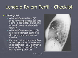 Dr. Emanuel R. Dantas
Lendo o Rx em Perfil - Checklist
► Diafragmas:
▪ O hemidiafragma direito (1)
pode ser visto passando por todo
o tórax e identificado claramente
cruzando através da borda do
coração.
▪ O hemidiafragma esquerdo (2)
parece desaparecer quando ele
alcança a borda posterior do
coração.
▪ Um outro método para identificar
os diafragmas é olhar a bolha de
ar do estômago (3). O diafragma
que está logo acima dela é o
diafragma esquerdo (2).
 