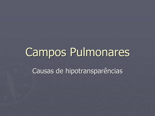 Campos Pulmonares
Causas de hipotransparências
 