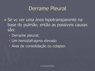 Dr. Emanuel R. Dantas
Derrame Pleural
►Se vc ver uma área hipotransparente na
base do pulmão, então as possíveis causas
são:
▪ Derrame pleural;
▪ Um hemidiafragma elevado
▪ Área de consolidação ou colapso.
 
