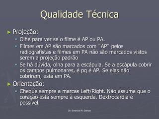 Dr. Emanuel R. Dantas
Qualidade Técnica
► Projeção:
▪ Olhe para ver se o filme é AP ou PA.
▪ Filmes em AP são marcados com “AP” pelos
radiografistas e filmes em PA não são marcados vistos
serem a projeção padrão
▪ Se há dúvida, olha para a escápula. Se a escápula cobrir
os campos pulmonares, é pq é AP. Se elas não
cobrirem, está em PA.
► Orientação:
▪ Cheque sempre a marcas Left/Right. Não assuma que o
coração está sempre à esquerda. Dextrocardia é
possível.
 