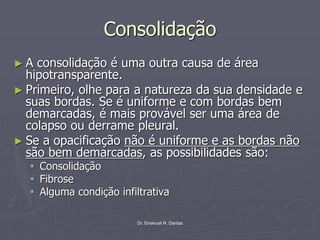 Dr. Emanuel R. Dantas
Consolidação
► A consolidação é uma outra causa de área
hipotransparente.
► Primeiro, olhe para a natureza da sua densidade e
suas bordas. Se é uniforme e com bordas bem
demarcadas, é mais provável ser uma área de
colapso ou derrame pleural.
► Se a opacificação não é uniforme e as bordas não
são bem demarcadas, as possibilidades são:
▪ Consolidação
▪ Fibrose
▪ Alguma condição infiltrativa
 