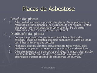 Dr. Emanuel R. Dantas
Placas de Asbestose
2. Posição das placas:
1. Olhe cuidadosamente a posição das placas. Se as placas segue
estruturas intrapulmonares (ex.: um lobo de um pulmão), então
elas podem ser originadas do próprio pulmão. Se ela cruza
estruturas, então é mais provável ser pleural.
3. Distribuição das placas:
1. Compare a posição das placas com as linhas anterior das
costelas. Placas de asbetos são mais comumente vistas ao longo
das linhas anteriores das costelas.
2. As placas pleurais são mais prevalentes no terço médio. Elas
tendem a poupar as zonas superiores e ângulos costofrênicos.
3. Olha atentamente para ambos os pulmões. As placas pleurais são
usualmente bilaterais e vc deve ter cuidado em fazer este
diagnóstico quando observá-las em apenas um pulmão.
 