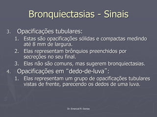 Dr. Emanuel R. Dantas
Bronquiectasias - Sinais
3. Opacificações tubulares:
1. Estas são opacificações sólidas e compactas medindo
até 8 mm de largura.
2. Elas representam brônquios preenchidos por
secreções no seu final.
3. Elas não são comuns, mas sugerem bronquiectasias.
4. Opacificações em “dedo-de-luva”:
1. Elas representam um grupo de opacificações tubulares
vistas de frente, parecendo os dedos de uma luva.
 