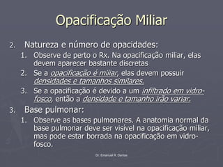 Dr. Emanuel R. Dantas
Opacificação Miliar
2. Natureza e número de opacidades:
1. Observe de perto o Rx. Na opacificação miliar, elas
devem aparecer bastante discretas
2. Se a opacificação é miliar, elas devem possuir
densidades e tamanhos similares.
3. Se a opacificação é devido a um infiltrado em vidro-
fosco, então a densidade e tamanho irão variar.
3. Base pulmonar:
1. Observe as bases pulmonares. A anatomia normal da
base pulmonar deve ser visível na opacificação miliar,
mas pode estar borrada na opacificação em vidro-
fosco.
 