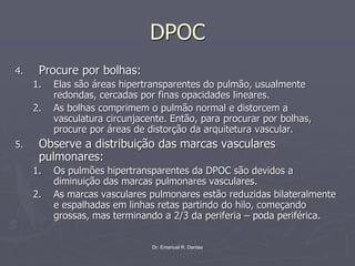 Dr. Emanuel R. Dantas
DPOC
4. Procure por bolhas:
1. Elas são áreas hipertransparentes do pulmão, usualmente
redondas, cercadas por finas opacidades lineares.
2. As bolhas comprimem o pulmão normal e distorcem a
vasculatura circunjacente. Então, para procurar por bolhas,
procure por áreas de distorção da arquitetura vascular.
5. Observe a distribuição das marcas vasculares
pulmonares:
1. Os pulmões hipertransparentes da DPOC são devidos a
diminuição das marcas pulmonares vasculares.
2. As marcas vasculares pulmonares estão reduzidas bilateralmente
e espalhadas em linhas retas partindo do hilo, começando
grossas, mas terminando a 2/3 da periferia – poda periférica.
 
