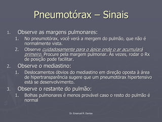 Dr. Emanuel R. Dantas
Pneumotórax – Sinais
1. Observe as margens pulmonares:
1. No pneumotórax, você verá a mergem do pulmão, que não é
normalmente vista.
2. Observe cuidadosamente para o ápice onde o ar acumulará
primeiro. Procure pela margem pulmonar. Às vezes, rodar o Rx
de posição pode facilitar.
2. Observe o mediastino:
1. Deslocamentos óbvios do mediastino em direção oposta à área
de hipertransparência sugere que um pneumotórax hipertensivo
está se desenvolvimento.
3. Observe o restante do pulmão:
1. Bolhas pulmonares é menos provável caso o resto do pulmão é
normal
 