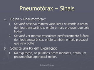 Dr. Emanuel R. Dantas
Pneumotórax – Sinais
4. Bolha x Pneumotórax:
1. Se você observa marcas vasculares cruzando a áreas
de hipertransparência, então é mais provável que seja
bolha.
2. Se você ver marcas vasculares perifericamente à área
de hipetransparência, então também é mais provável
que seja bolha.
5. Solicite um Rx em Expiração:
1. Na expiração, os pulmões ficam menores, então um
pneumotórax aparecerá maior.
 