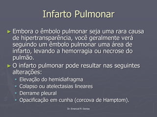 Dr. Emanuel R. Dantas
Infarto Pulmonar
► Embora o êmbolo pulmonar seja uma rara causa
de hipertransparência, você geralmente verá
seguindo um êmbolo pulmonar uma área de
infarto, levando a hemorragia ou necrose do
pulmão.
► O infarto pulmonar pode resultar nas seguintes
alterações:
▪ Elevação do hemidiafragma
▪ Colapso ou atelectasias lineares
▪ Derrame pleural
▪ Opacificação em cunha (corcova de Hamptom).
 